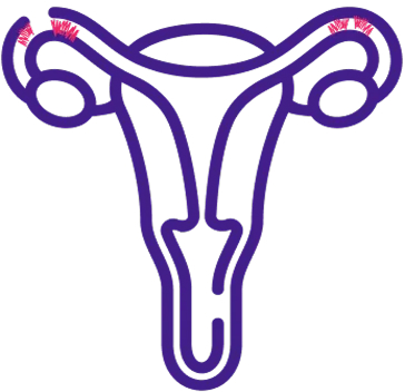 Fallopian Tube Recanalization icon